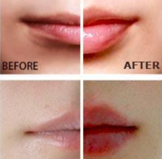 Miracle Lippenbooster